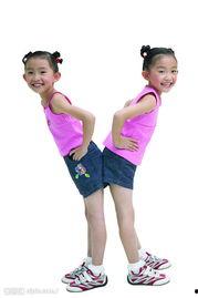 背弯照片,揭秘脊椎弯曲的秘密